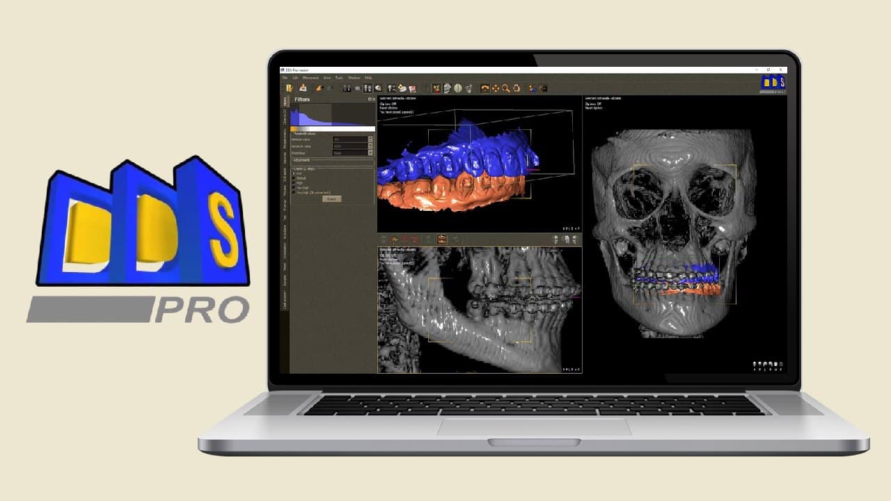 DDP Systems DDS Pro v2.6.1 - Herramientas y utilidades: Software Profesional