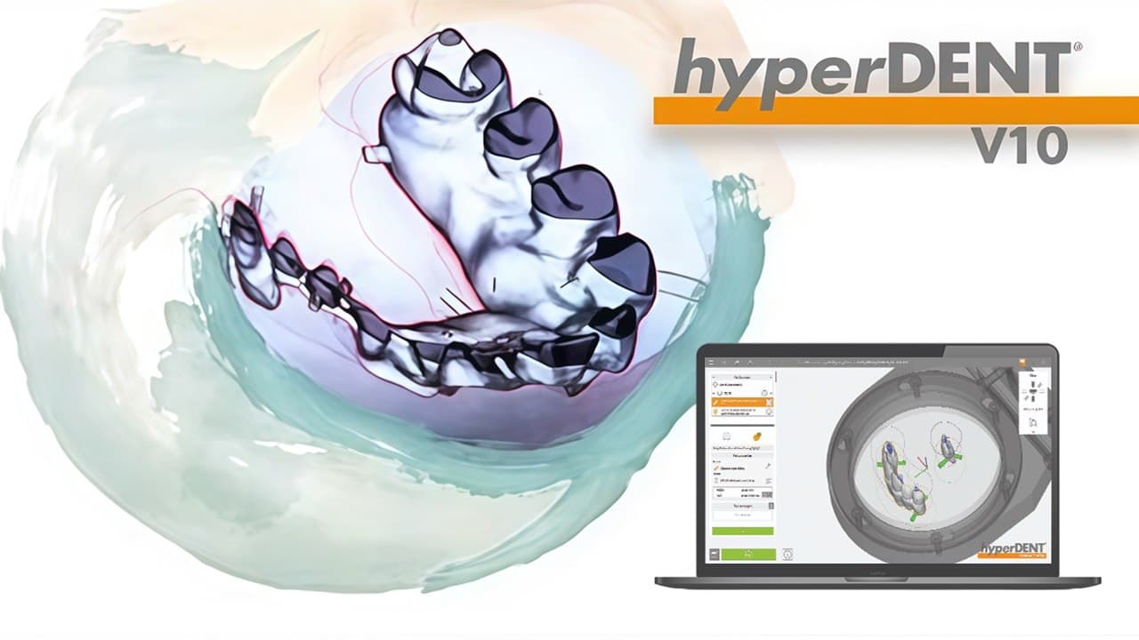 hyperDENT v10.0.2 - Dental: Software Profesional