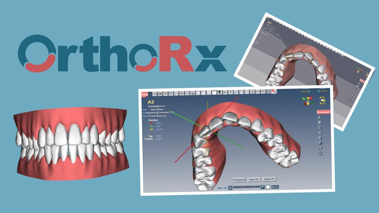 iROK OrthoRx 6.2 - Dental: Software Profesional