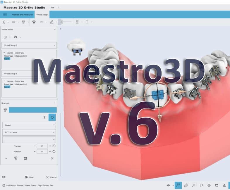 Maestro 3D v6 - Dental: Software Profesional