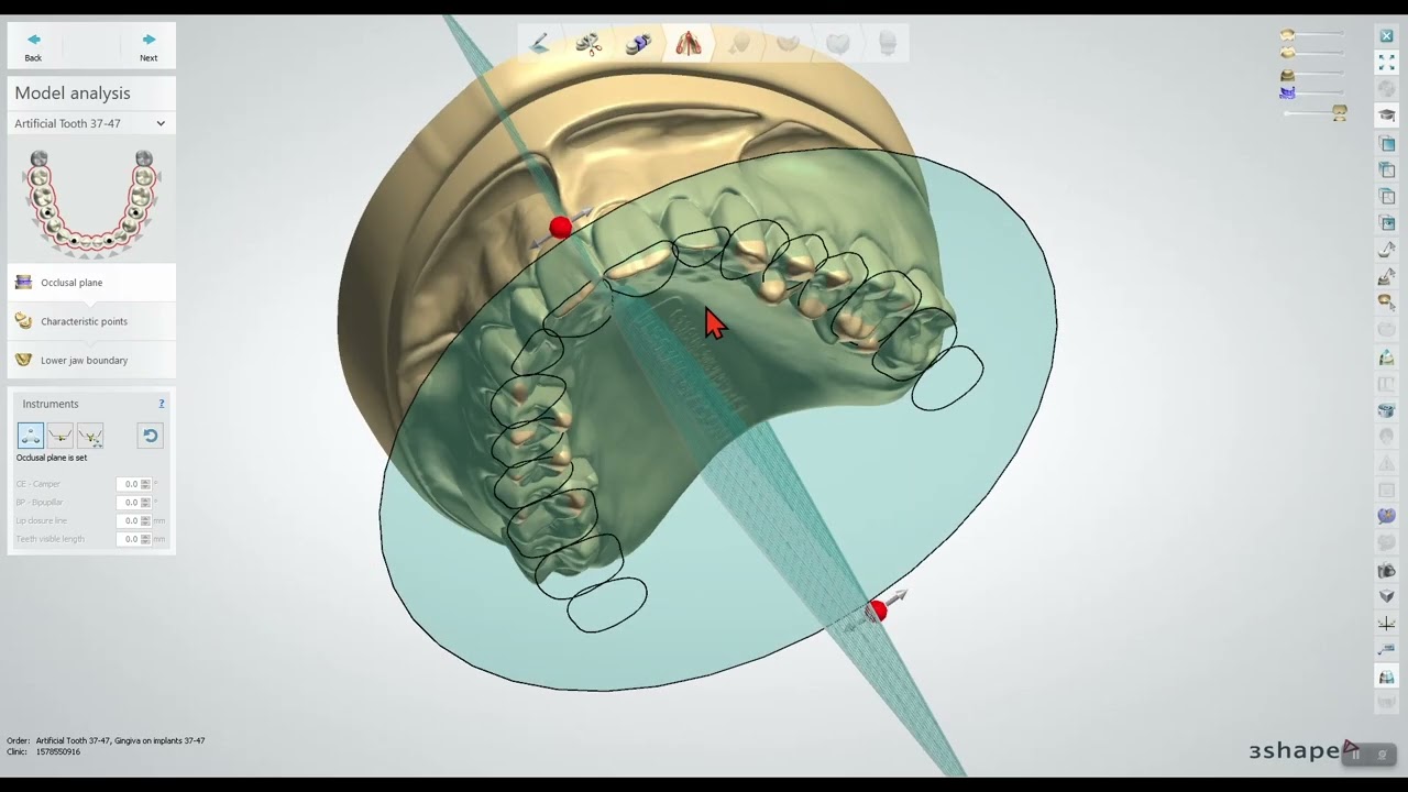Imagen 2 del producto 3Shape Dental System 2024