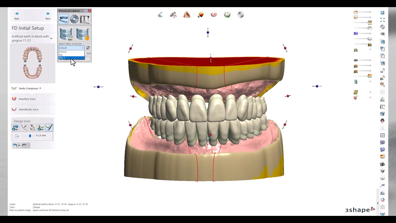 Imagen 3 del producto 3Shape Dental System 2024
